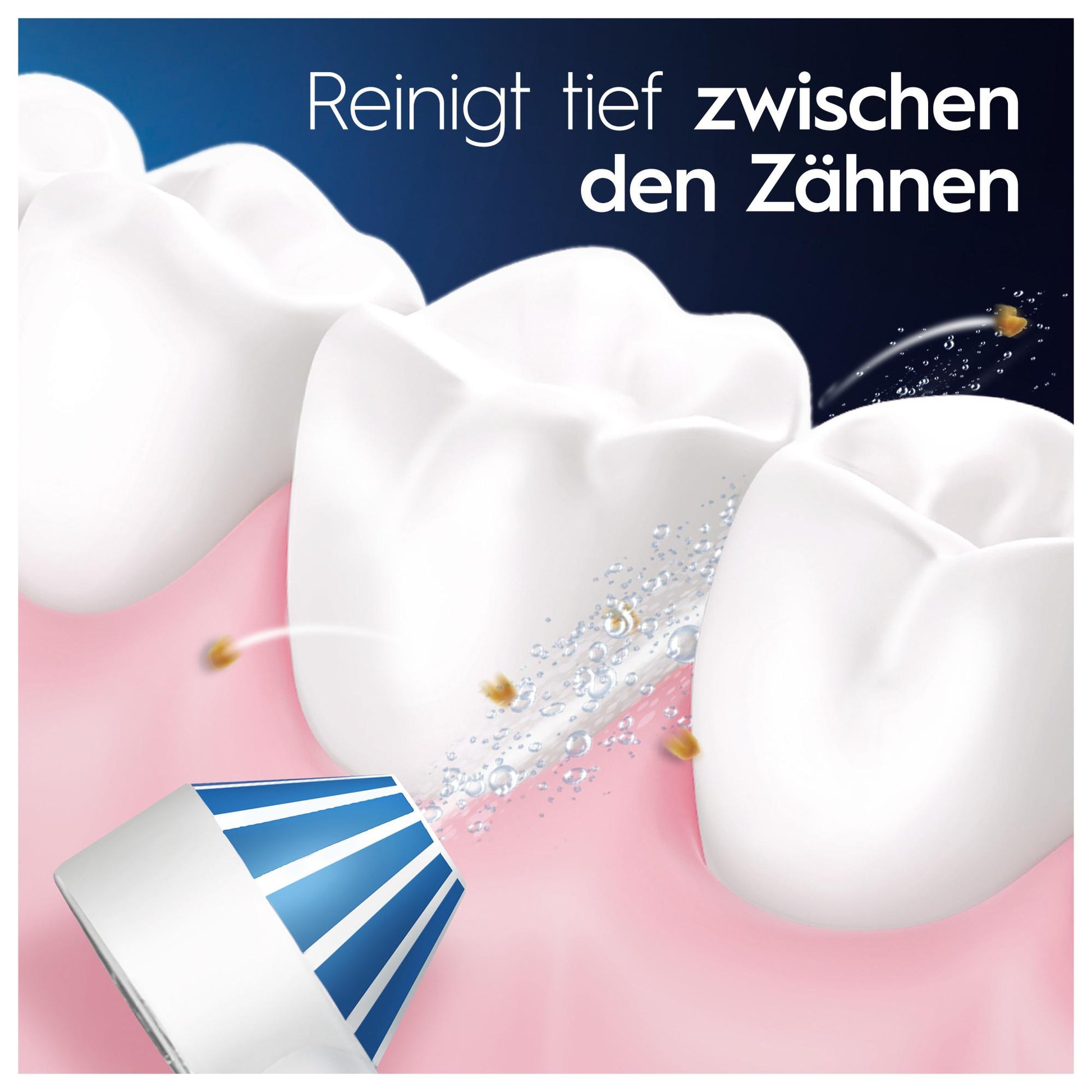 Oral-B Munddusche Oxyjet (Oxyjet-Technologie, 5 Wasserdruck-Stufen, 4 Wasserstrahle, perfekt für Zahnspangen und Implantate, Lieferumfang: 1 Munddusche, 1 Oxyjet-Düse, 1 Waterjet-Düse) - TRONYQ